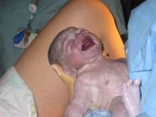 Ein Neugeborenes bei den ersten Atemzügen
